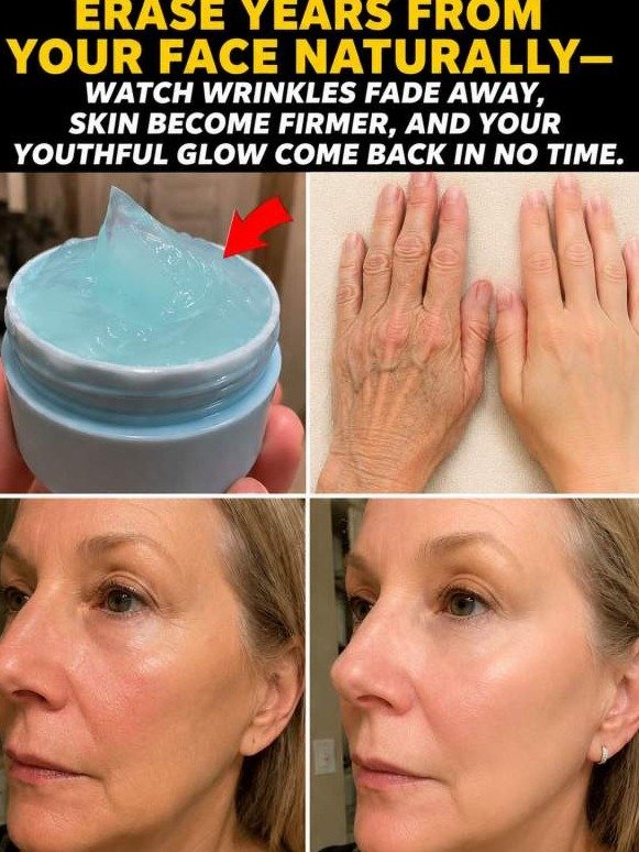 Forget Botox: This 'Icy Blue' Gel Is The Viral Secret Erasing Mouth Wrinkles & Rebuilding Skin!