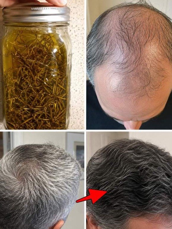 You're Missing Out: This Forgotten Oil Blend Wakes Up Thinning Hair – Even If You're 65 or 70!