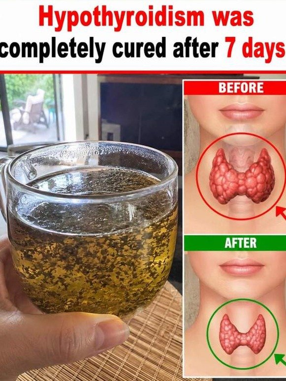 The $2 Herb That Revives Your Thyroid While You Sleep (Doctors Won't Tell You)