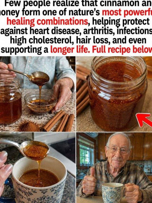 The ONE Morning Habit You're Missing: How Cinnamon & Honey Can Unlock Your Body's Hidden Power and Erase Aches!