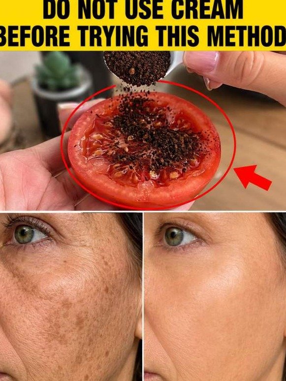 The SHOCKING Kitchen Secret That ZAPS Sun-Darkened Skin & Dark Spots FASTER Than Anything Else!