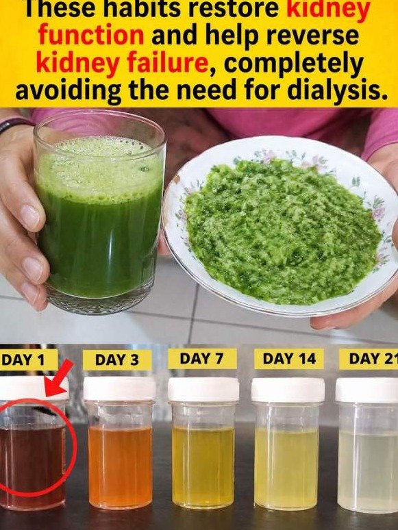 The Silent Habit That's Destroying Your Kidneys (Most People Do It Daily Without Realizing)