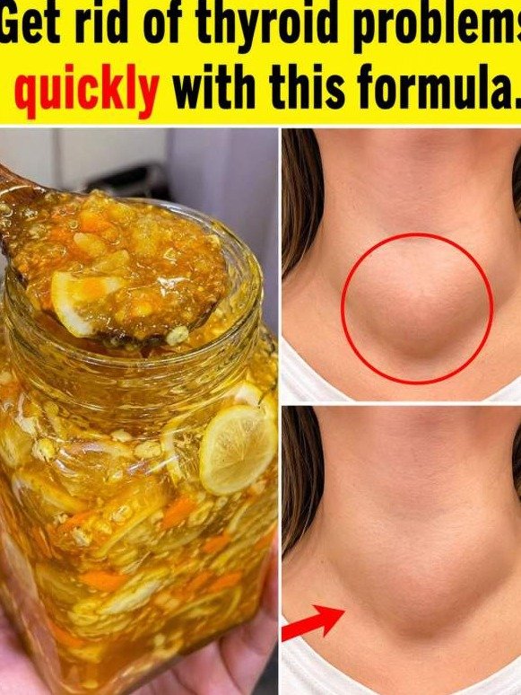 Tired of Thyroid Trouble? This 2-Ingredient Kitchen Hack Is Changing Lives (and It's NOT What You Think!)