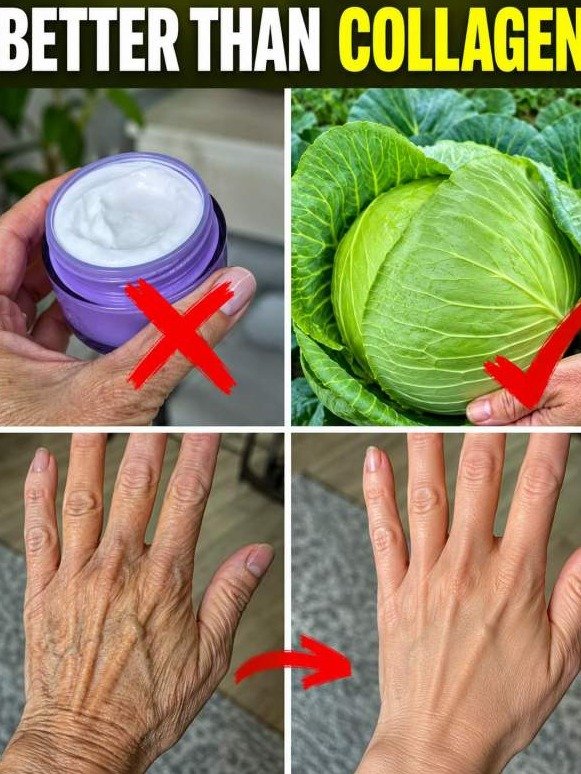 The Collagen Industry Doesn't Want You To Know This: What Cabbage Triggers Inside Your Aging Skin (It's NOT What You Think!)