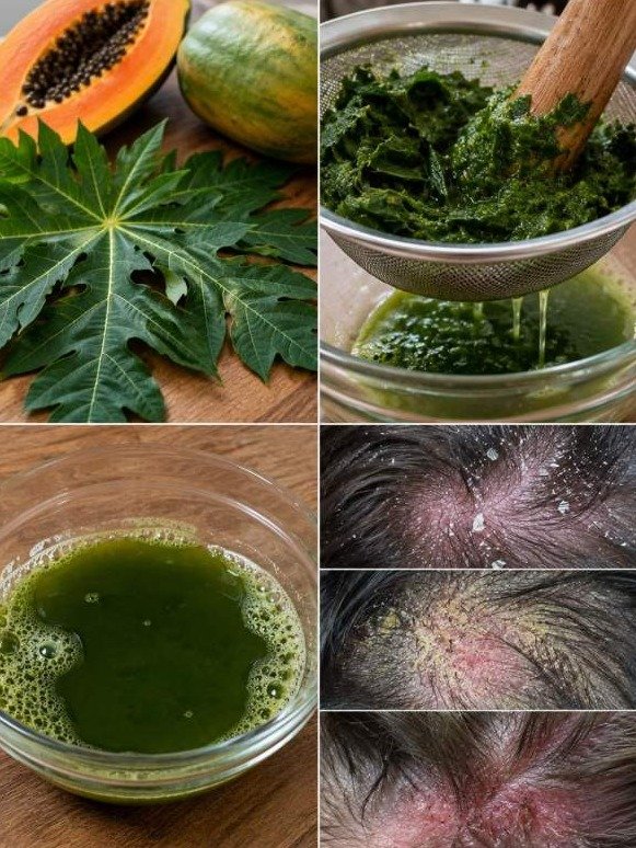 The #1 Secret Your Scalp is Hiding: Papaya Leaves Reveal How to Wake Up Dormant Hair FAST!