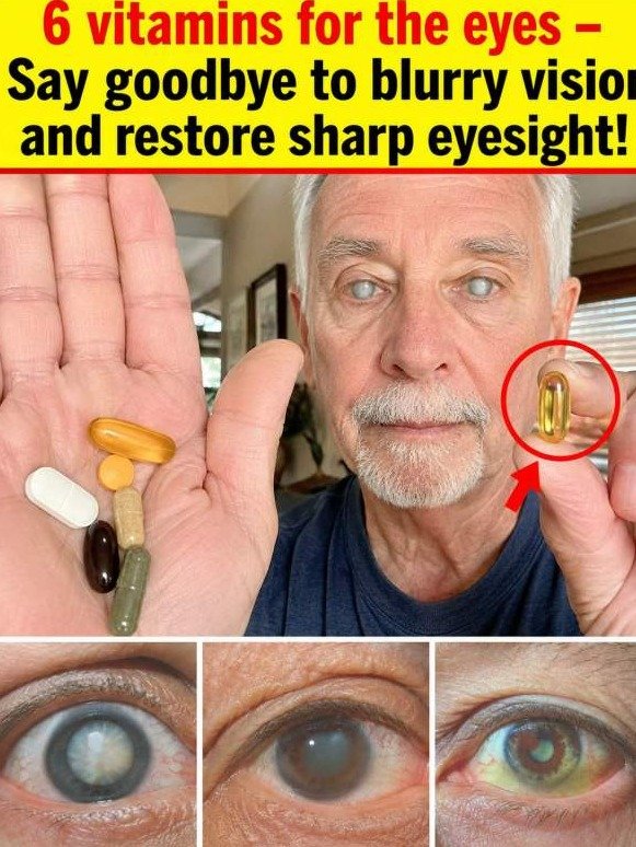 6 Essential Vitamins to Reverse Blurry Vision and Restore Crystal-Clear Focus