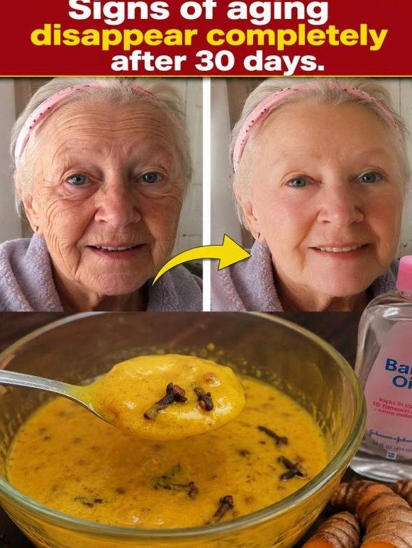 The Hidden Clove Oil Secret That Unlocks Flawless Skin (And The 1 Mistake Everyone Makes)
