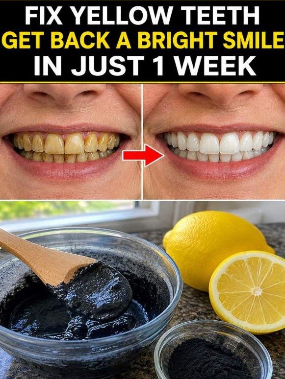 The 7 Shocking Kitchen Hacks That Will Whiten Your Teeth & STOP Cavities Dead in Their Tracks!