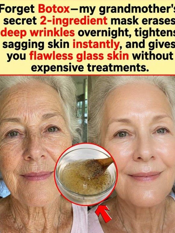 Forget Botox: This 3-Ingredient Kitchen Hack Erases Wrinkles While You Sleep