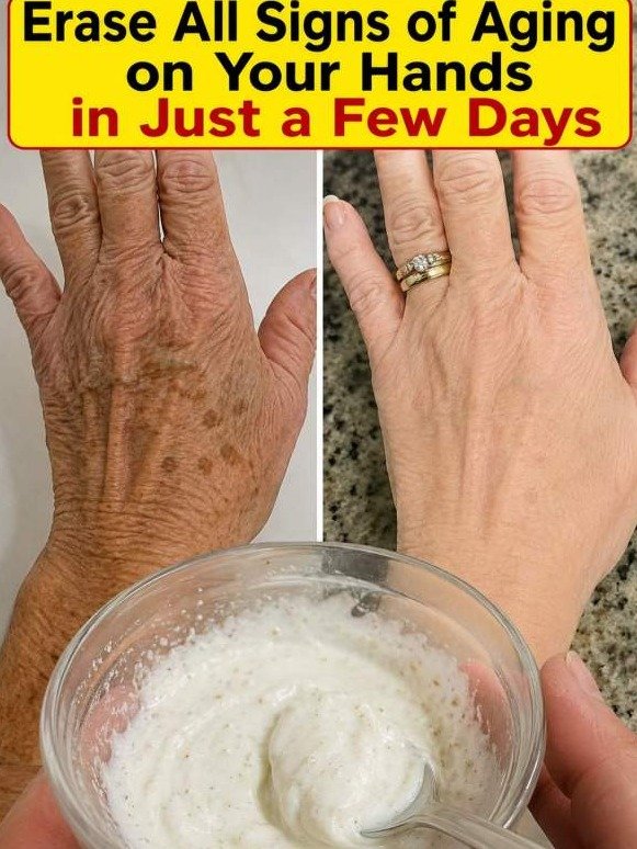 The Viral 1-Minute Colgate Hack: Can This Toothpaste REALLY Make Your Wrinkled Hands Look Years Younger?