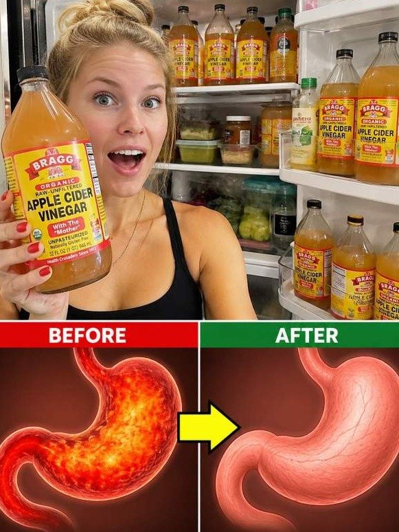 Shocking Truth: Just 1 Tablespoon of Apple Cider Vinegar Triggers a Gut Reset Your Body Is Begging For!