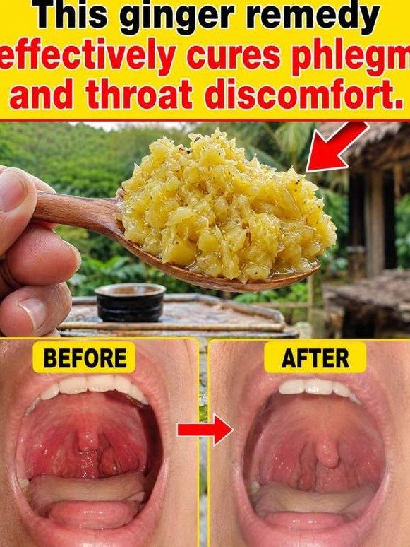 This $2 Ginger Trick Flushes Out Throat Phlegm Overnight—Doctors Hate How Simple It Is