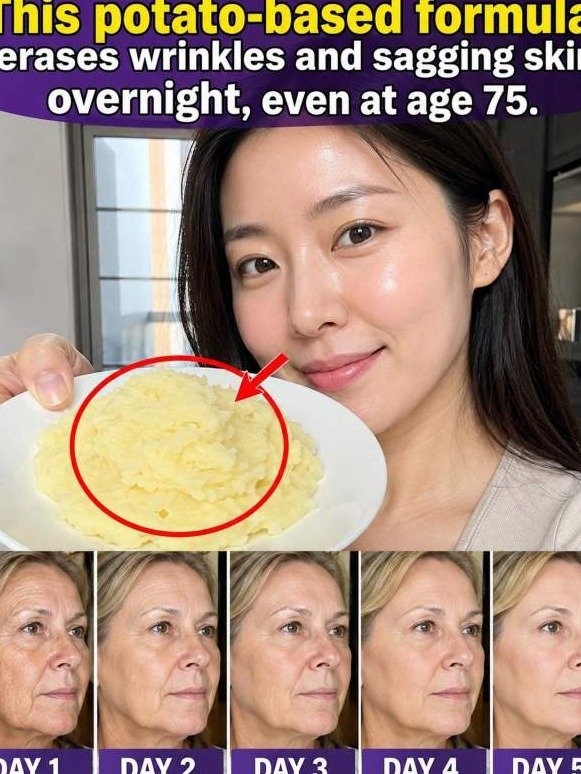 The $0.50 Potato Trick That Erases Wrinkles Overnight — Dermatologists Are Furious You Know This