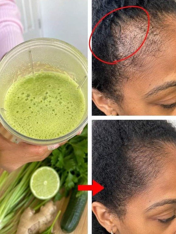 Your Scalp Is Clogged: This Forgotten Papaya Leaf Secret Unlocks Unbelievable Hair Growth & A Flawless Scalp – Don't Miss Out!