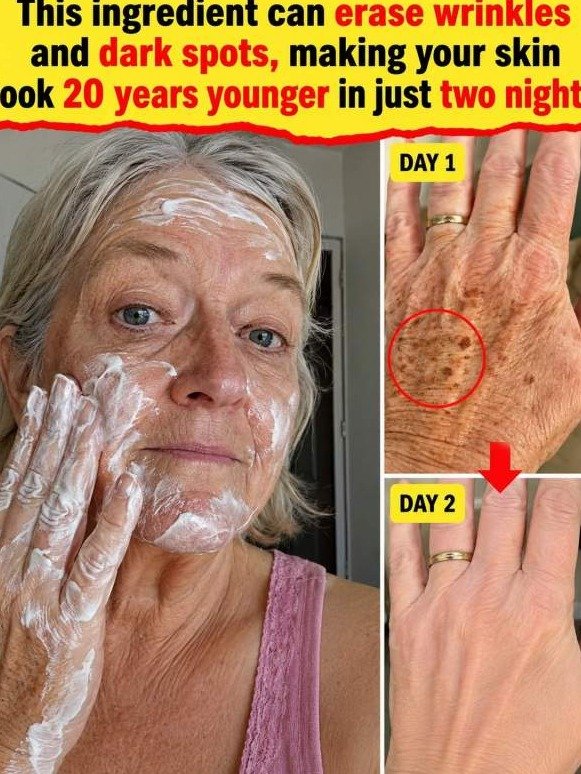 The Kitchen Duo That's Erasing Age Spots From Hands Overnight (Dermatologists Are Surprised)