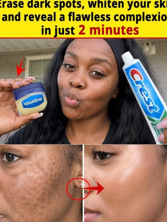 The Vaseline and Toothpaste Hack: Why Your Skin Is Suddenly Looking Flawless