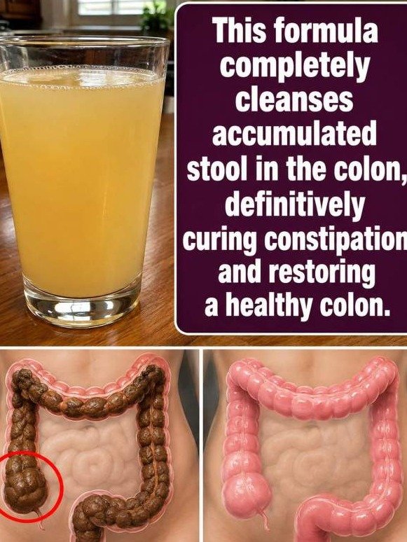 The "Concrete" Colon Hack: Why Chia Seeds and Black Honey Are the Natural Duo You Need