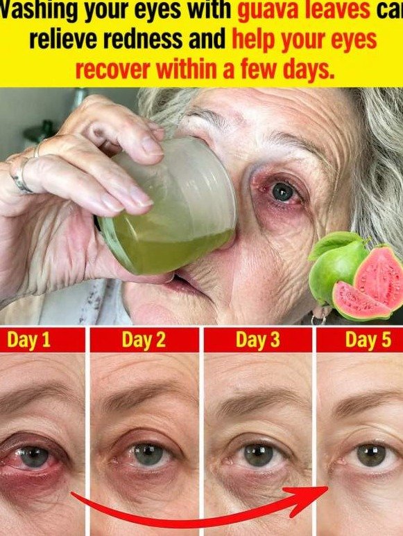 The Shocking Guava Leaf Secret Seniors Are Using to INSTANTLY Banish Red, Blurry Eyes (And Why Big Pharma Hates It!)