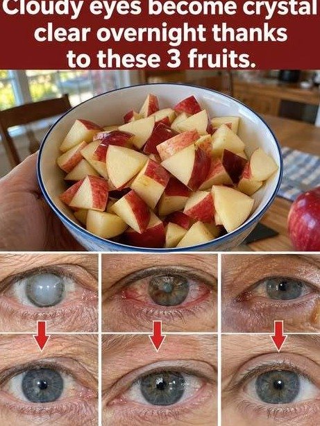 Cloudy Vision? These 3 Everyday Fruits Are Activating a Hidden 'Cleanup Crew' Inside Your Eyes (Don't Miss Out!)