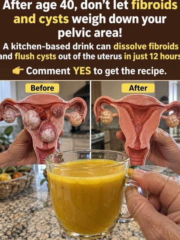 Feeling 'Heavy' After 40? This Simple Kitchen Brew Could Be the Game-Changer for Fibroids & Cysts You've Been Waiting For!