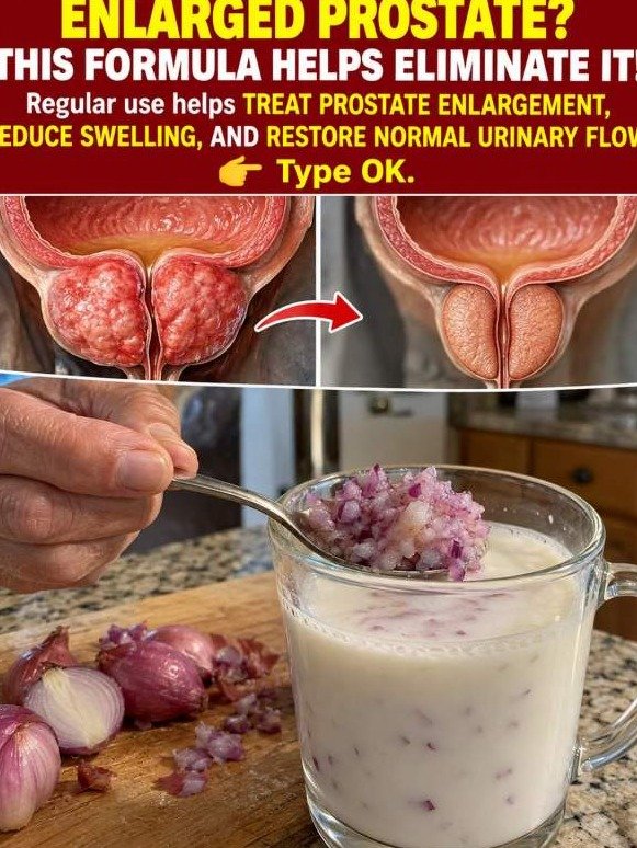 Why Doctors DON'T Want You to Know This $2 Onion Hack for Prostate Pressure and All-Night Sleep