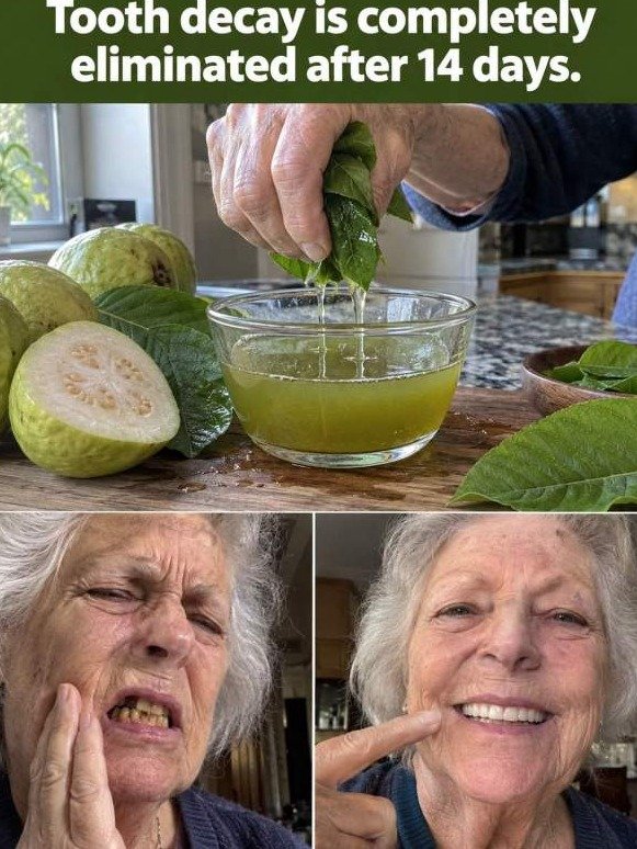 The Shocking Mouth Reset: Guava Leaves Are Starving Your Tooth Decay (And No One Told You!)