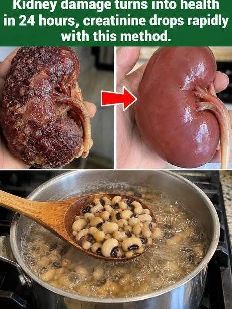 Is High Creatinine Crushing Your Kidneys? Uncover the 7 Everyday Foods That Can Drastically Lighten Their Load and Save You!