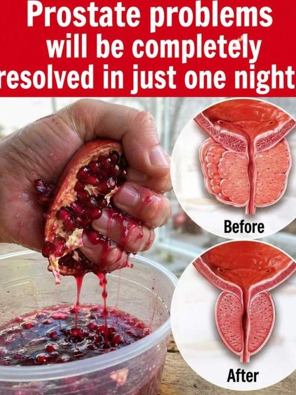 The Secret Avocado Hack That Forces Your Prostate to Relax and END Nighttime Urges