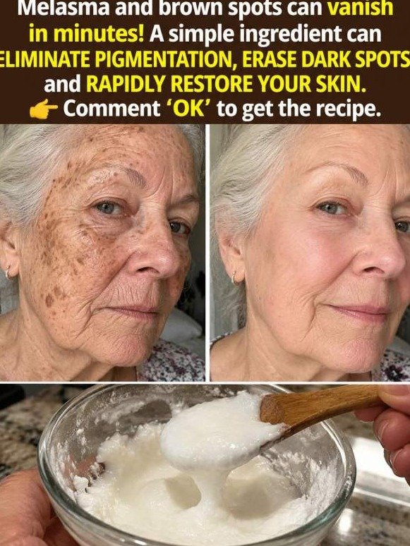 STOP Using Baking Soda for Dark Spots Until You Read This: The SHOCKING Truth About What It Does To Your Skin