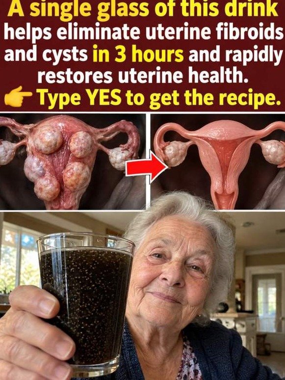 Fibroids & Cysts After 42: What Ginger and Turmeric Are ACTUALLY Triggering Inside Your Uterus (And Why You're Missing Out!)