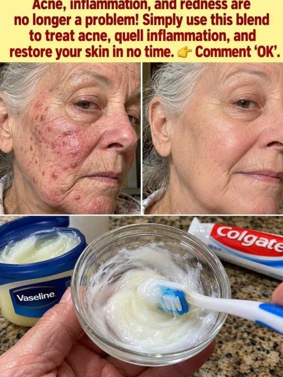 Forget Expensive Creams: This 2-Ingredient Bathroom Hack Gives You Brighter Skin Overnight (But There's a Catch!)