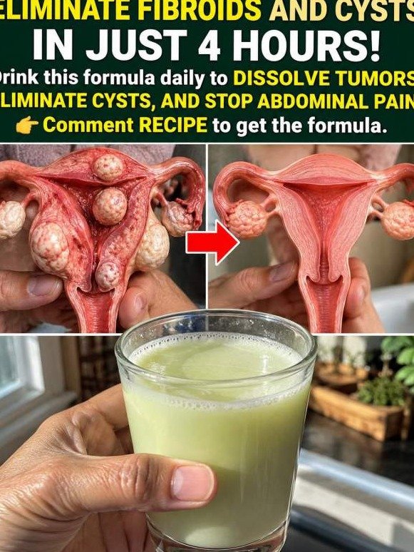 Women Over 45 Are Raving: This 3-Ingredient Drink *Erases* Pelvic Pressure & Bloating Fast!