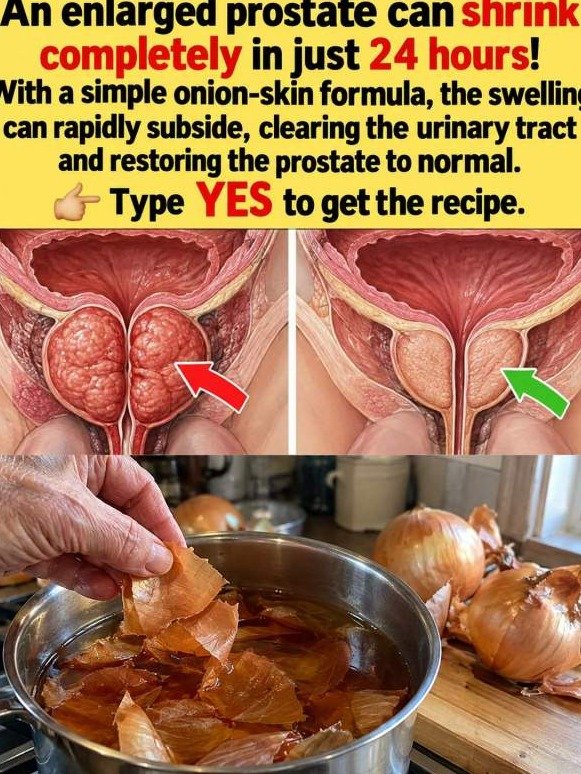 Are You Over 45? The 2 AM Bathroom Trips Could END With This Simple Kitchen Secret!
