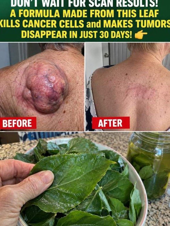 The #1 Herb Your Lungs, Skin, and Cells Are Screaming For: Oregano's Unstoppable Cleanup Revealed!