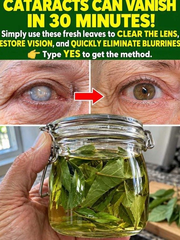 STOP! That Viral Leaf Trick for Cataracts Is a DANGEROUS Lie – Here’s Why You’re Risking Your Sight