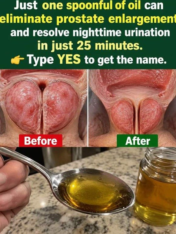 End 2 AM Bathroom Trips & Unleash a Stronger Stream: The Daily Oil Secret You're Missing!
