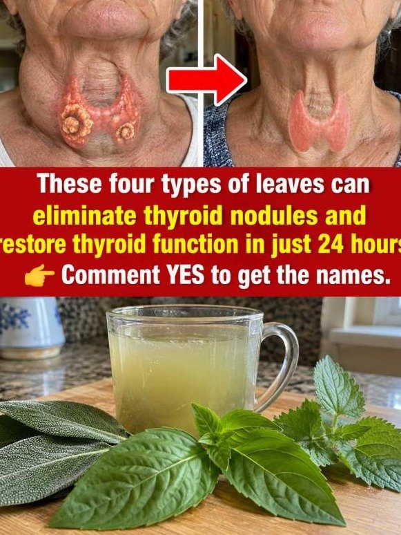 The Viral '4-Leaf Thyroid Reset': Why This Overnight Fix Is a Dangerous Illusion (And What REALLY Works)