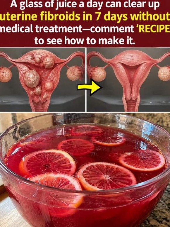 Fibroid Pressure Got You Down? This 1 Kitchen Drink Could Be Your Unsung Hero (and You're Missing Out!)