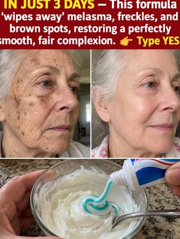 Viral Melasma Hack EXPOSED: What Toothpaste & Vaseline REALLY Do To Your Skin (And Why You Need To Stop NOW)