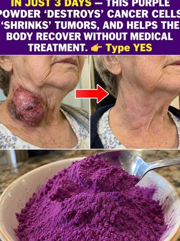 The Shocking Truth: This Purple Powder Triggers a Cellular Alarm Inside Tumors (No Chemo, No Surgery?)