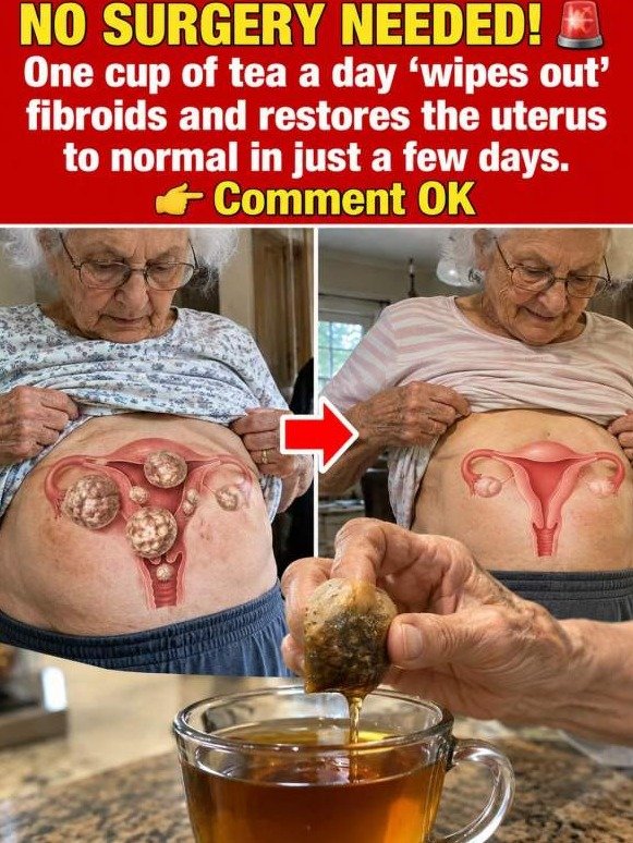 Your Pelvis is SCREAMING for a Reset: The Ginger & Turmeric Secret Fibroid Sufferers Need NOW!