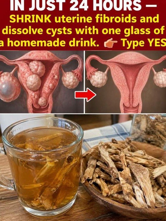 The Bitter Truth They HID: This Dark Drink Forces a FULL Reset on Stubborn Fibroids & Ovarian Cysts